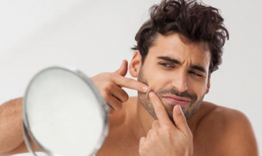 Những lý do khiến da nam giới thường xuyên bị nổi mụn