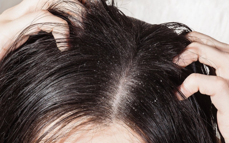 kiểu tóc, vitamin b5 có tác dụng gì cho tóc? hướng dẫn cách dùng đúng