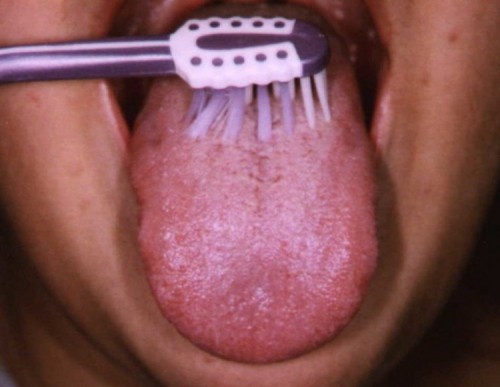 9 màu lưỡi bất thường báo hiệu cơ thể bạn mắc bệnh lý từ lâu