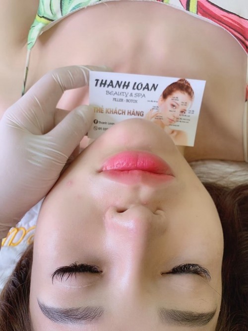 6 địa chỉ tiêm filler - botox uy tín và chất lượng nhất bắc giang