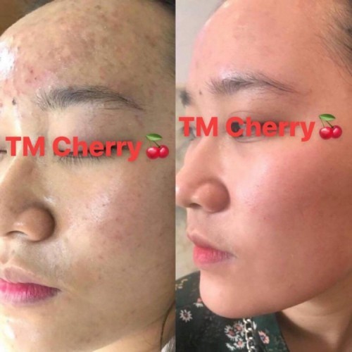 6 spa chăm sóc da mặt tốt nhất thanh hóa cho bạn trải nghiệm