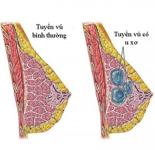 10 lợi ích của việc nuôi con bằng sữa mẹ