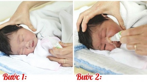 9 mẹo vặt trị ho và ngạt mũi cho trẻ 2 tháng tuổi