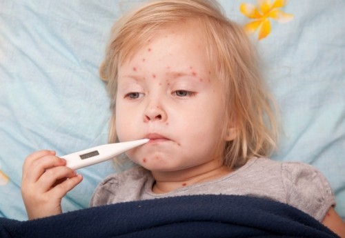 5 bệnh nguy hiểm nhất trẻ con hay mắc trong mùa hè