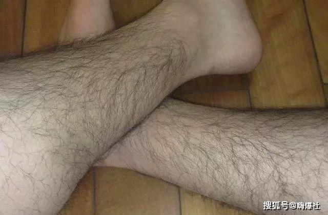 wax lông chân có hại không? sau khi wax lông nên bôi gì?