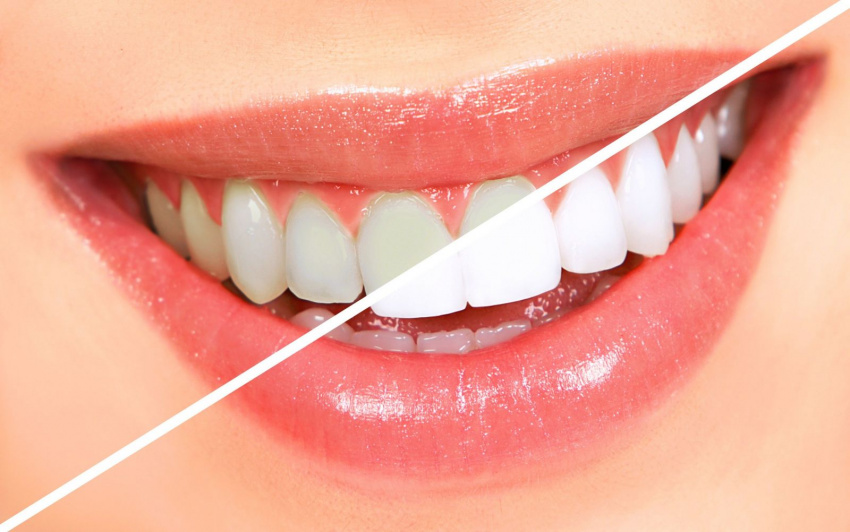 răng chắc khỏe, cách làm trắng răng, làm gì để răng chắc khỏe, mẹo giữ răng chắc khỏe, làm trắng răng, 3 việc nên làm mỗi ngày để hàm răng trắng và chắc khỏe